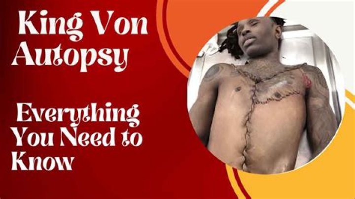 Autopsy Report Of King Von Reveals Startling Discoveries