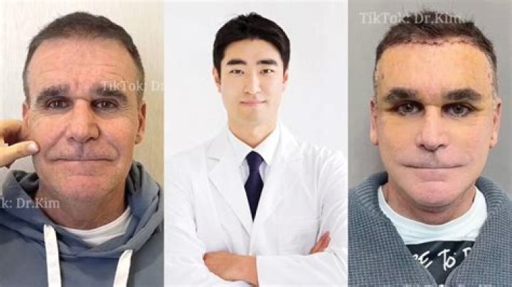 Unlocking The Secrets Of Taylor Love's Plastic Surgery Journey